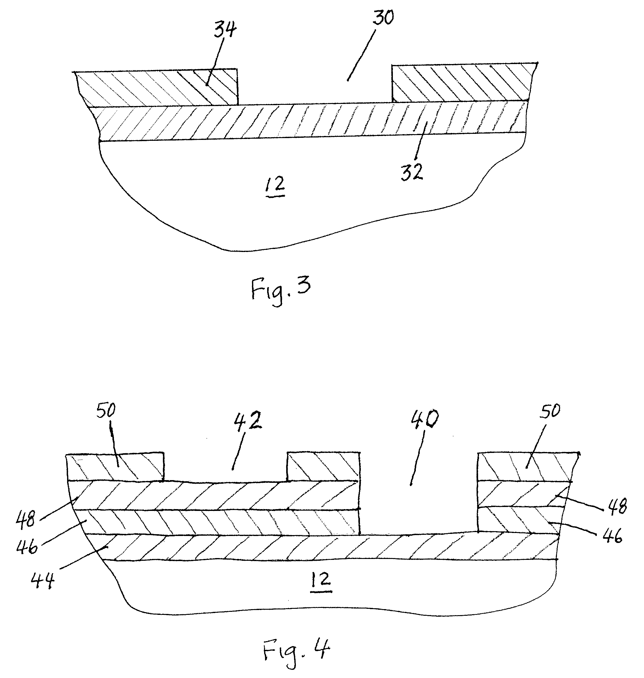 Stent and method for making a stent