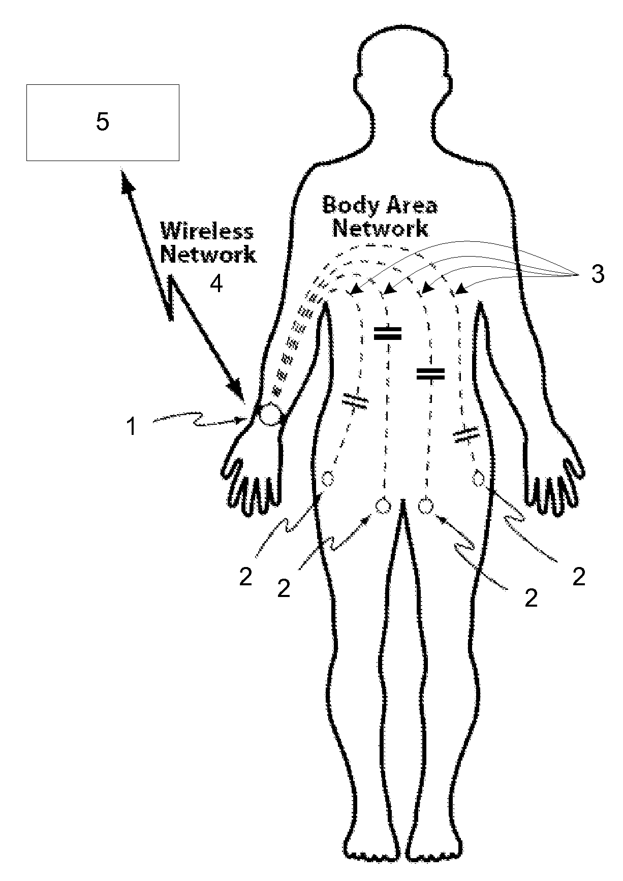 Wireless sensor system for monitoring skin condition using the body as communication conduit