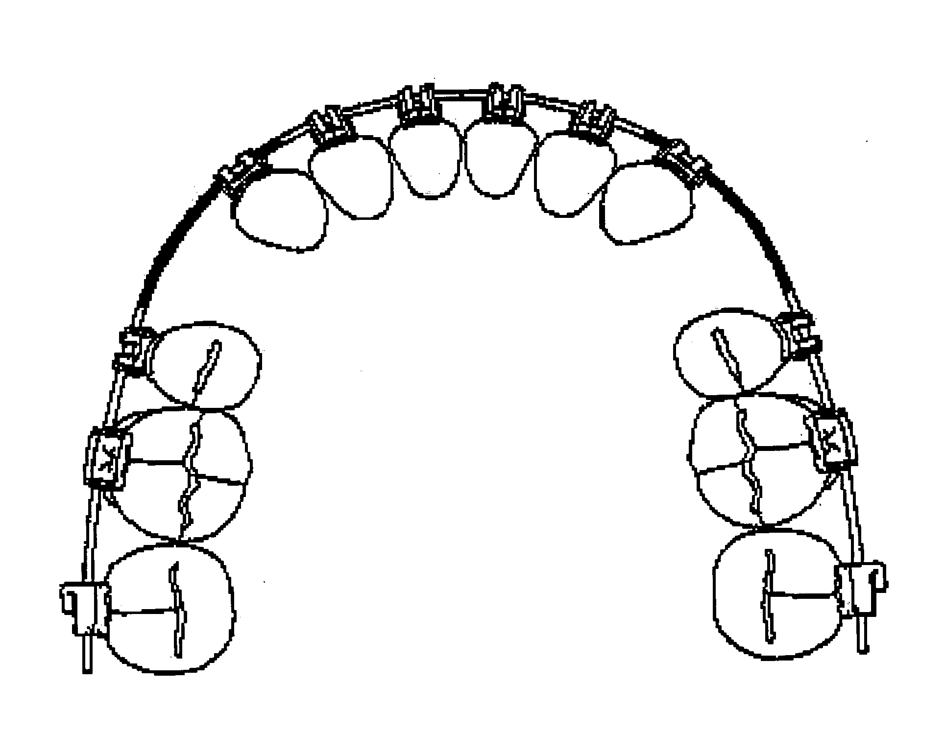 Five segment orthodontic arch wire and orthodontic apparatus made thereof