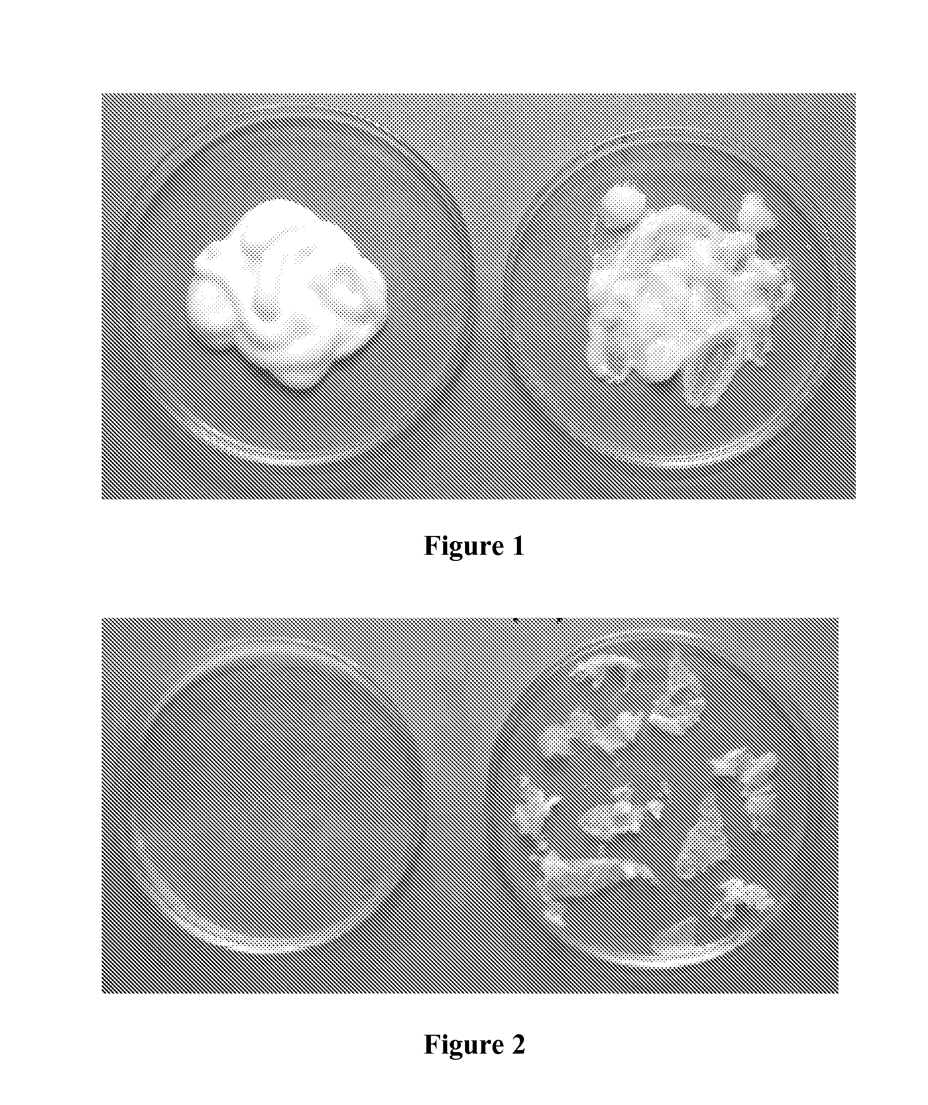 Medicinal antidiaper rash cream incorporating a biopolymer and a process to make it