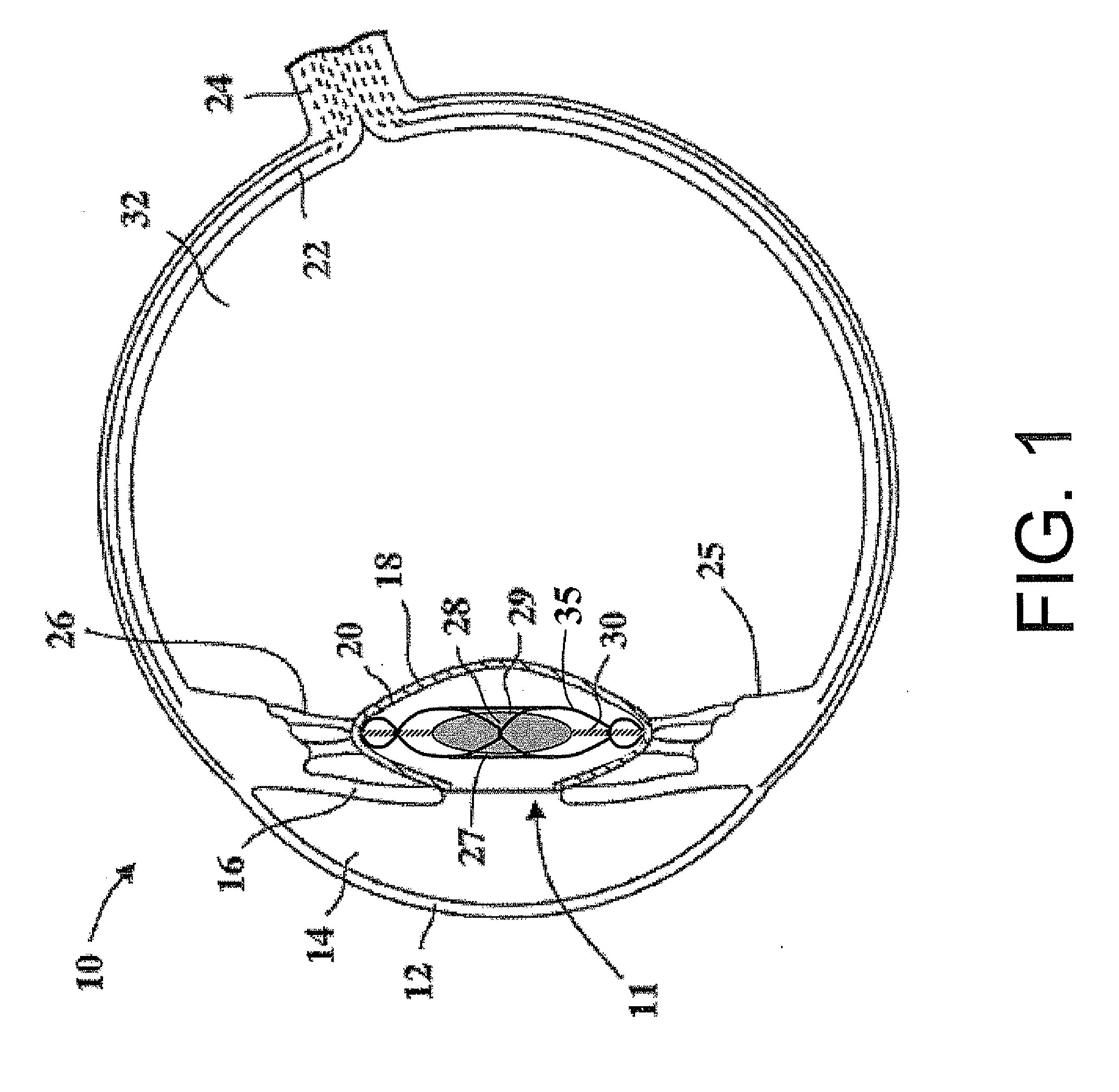 Intraocular lens and capsular ring