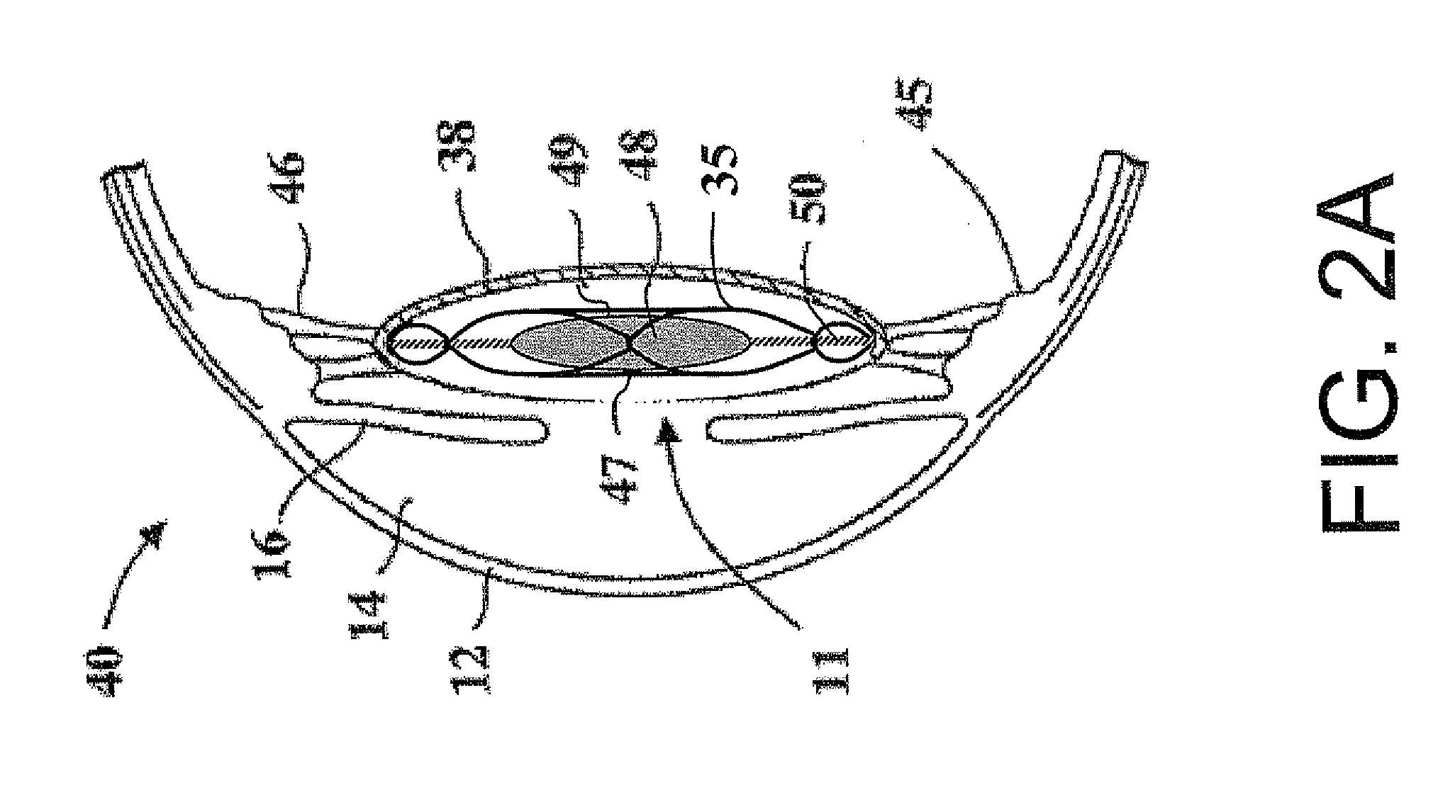 Intraocular lens and capsular ring