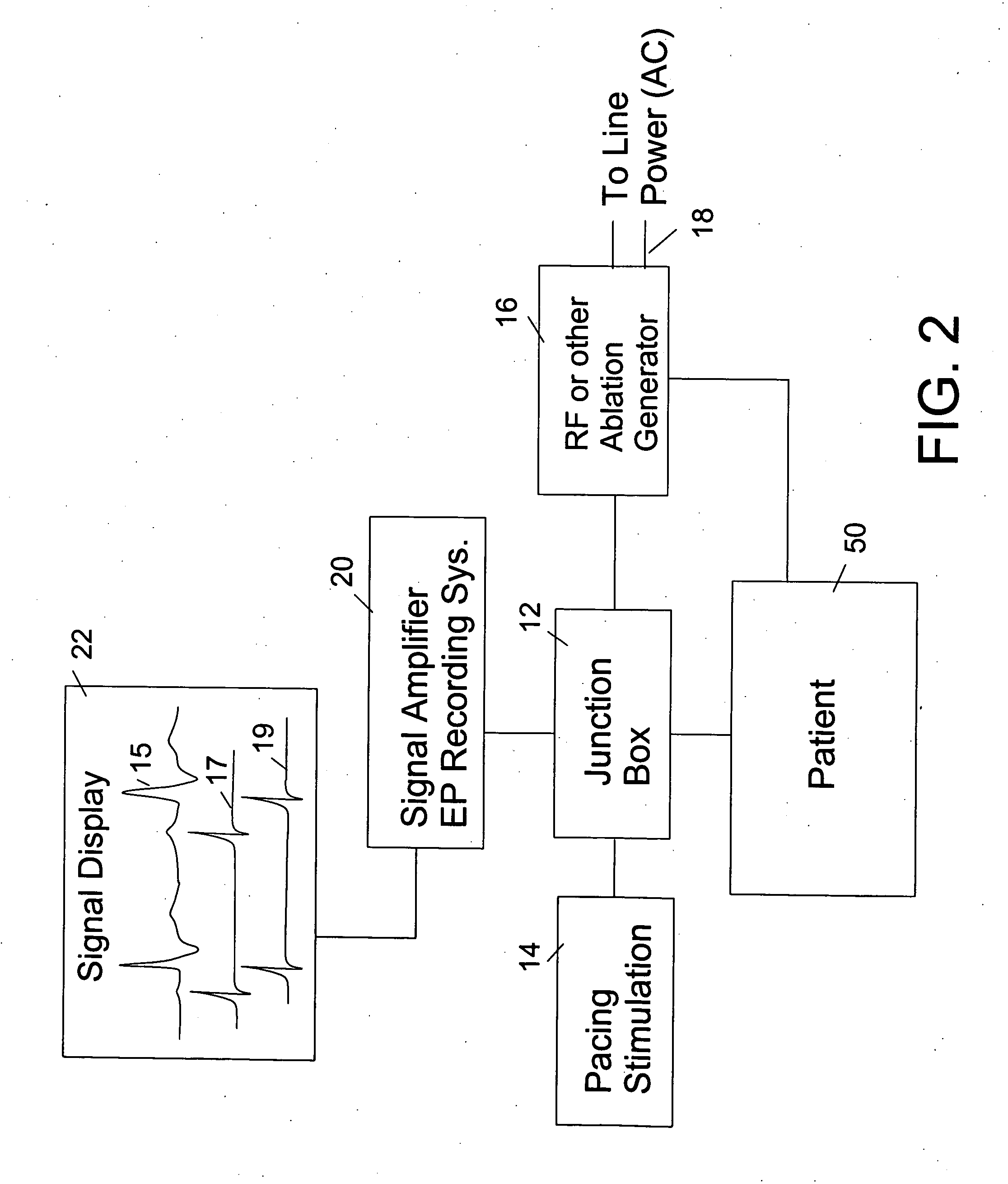 Method and system for monitoring atrial fibrillation ablations with an ablation interface device