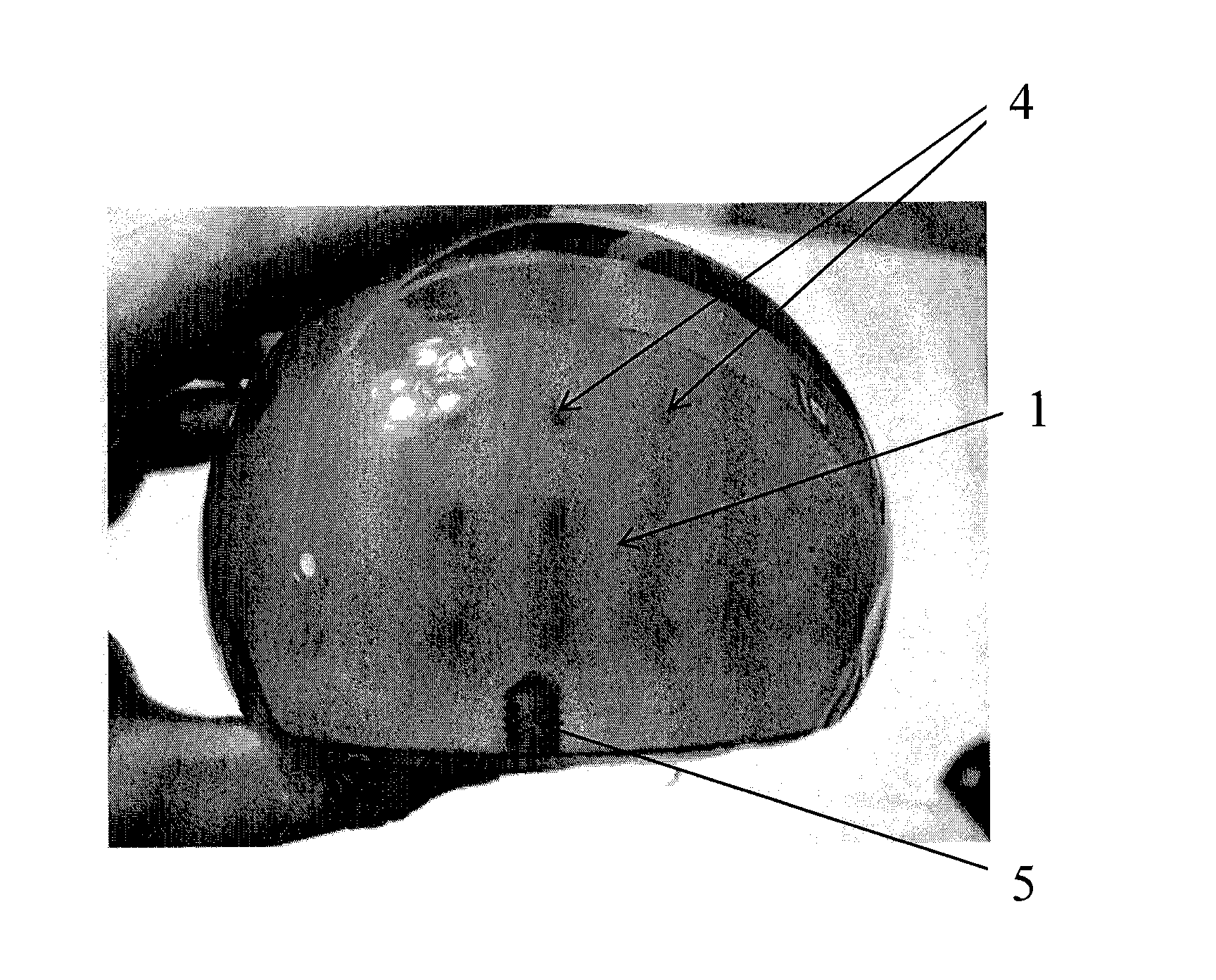 Radiation detector