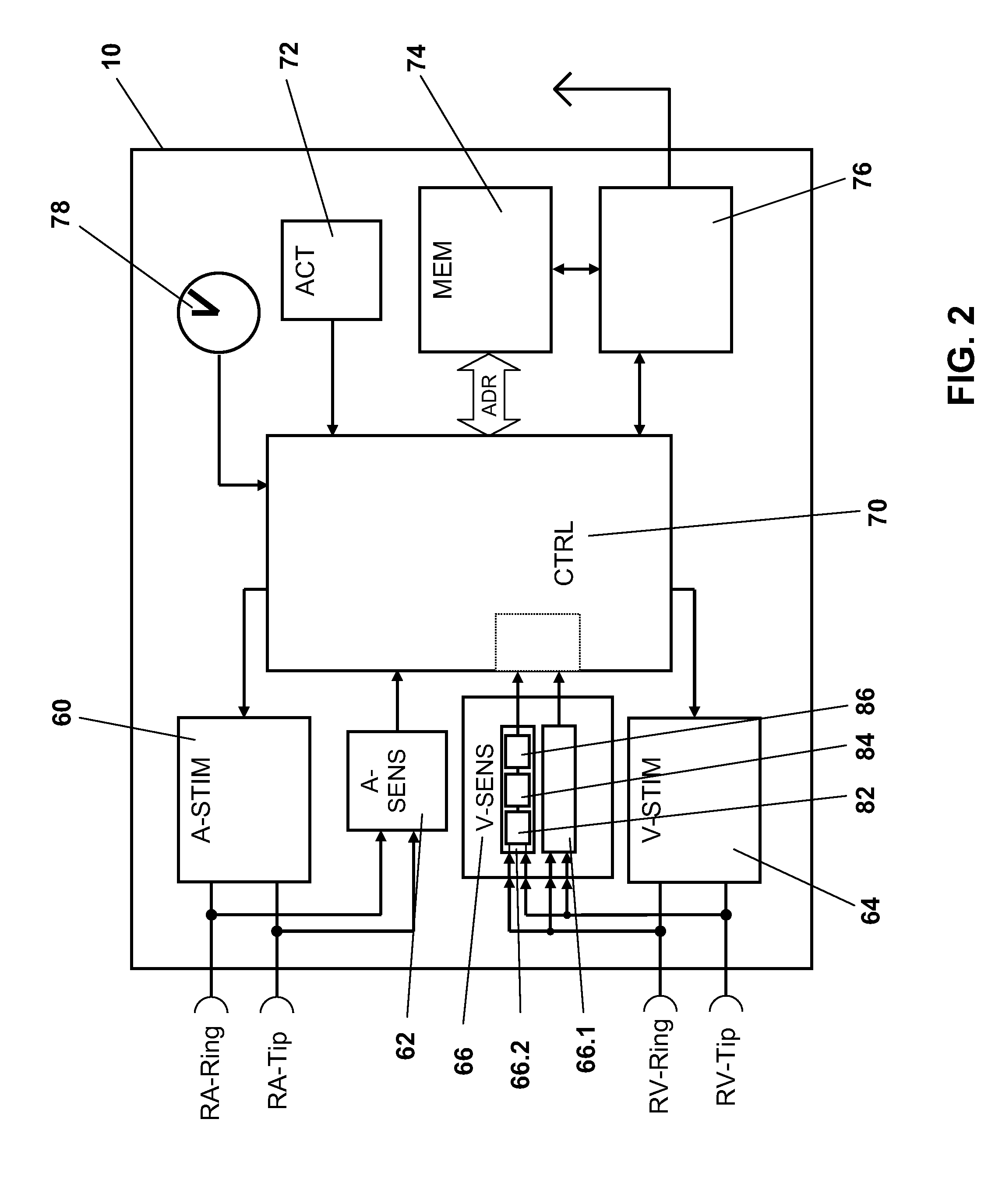 Technique for determining signal quality in a physiologic sensing system using high frequency sampling