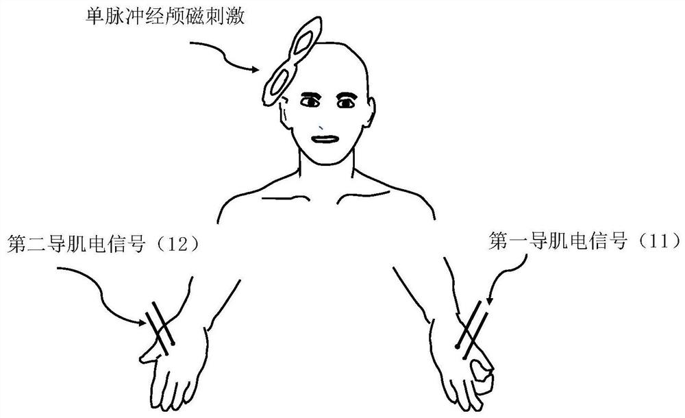 A method to extract the duration of cortical resting periods