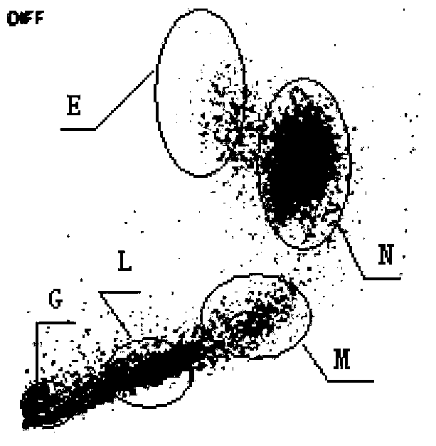 A kind of white blood cell classification hemolysis agent and its kit