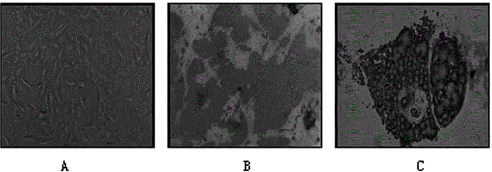 Application of mesenchymal stem cells in preparation of multiple sclerosis treatment medicines, and extraction method of mesenchymal stem cells