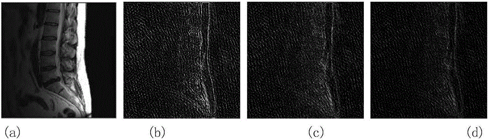 Three-regular magnetic resonance image reconstruction method based on Split Bregman iteration