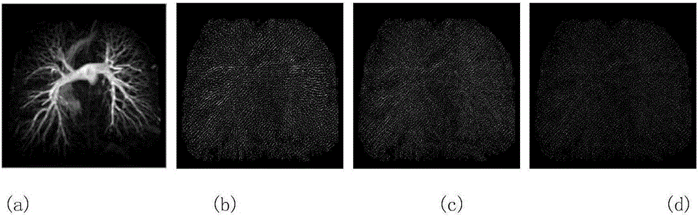Three-regular magnetic resonance image reconstruction method based on Split Bregman iteration