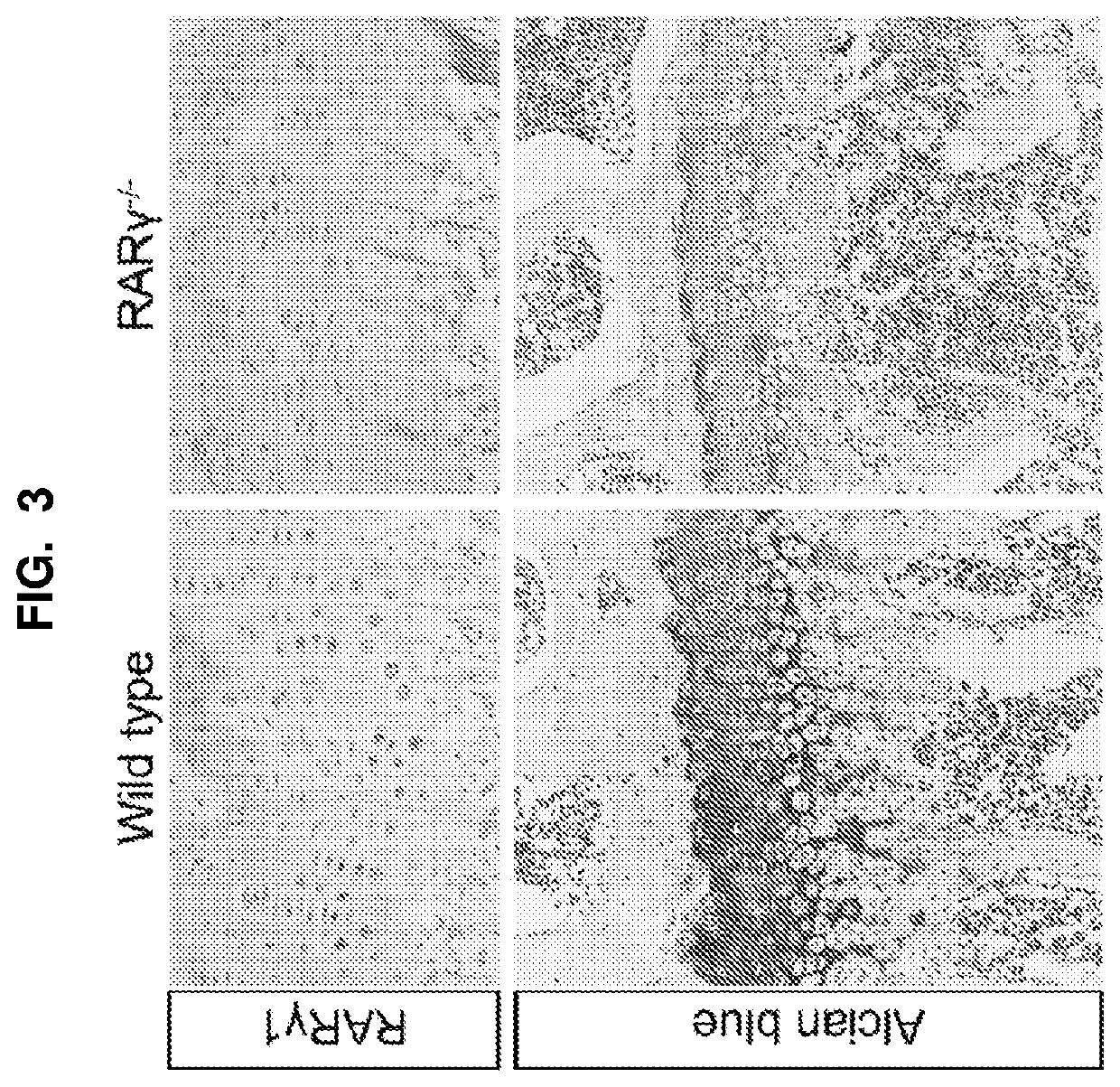 Selective RARy Ligand-loaded nanoparticles for manipulation of targeted bone growth