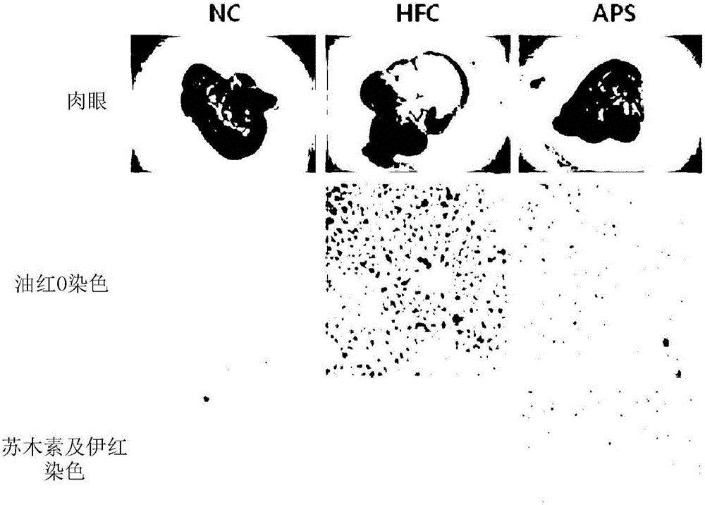Composition for preventing and treating non-alcoholic fatty liver diseases