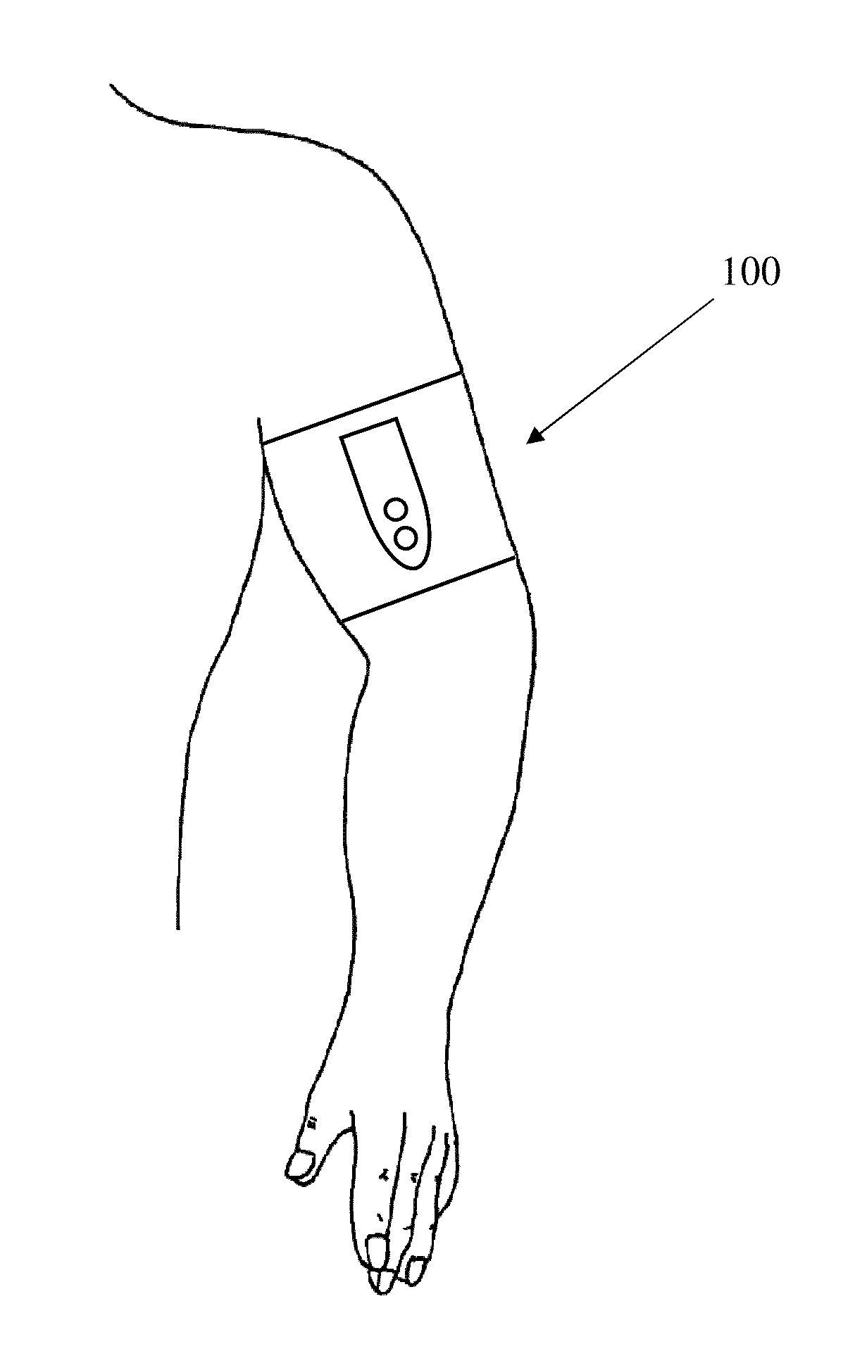 Dual mode remote ischemic preconditioning devices and methods