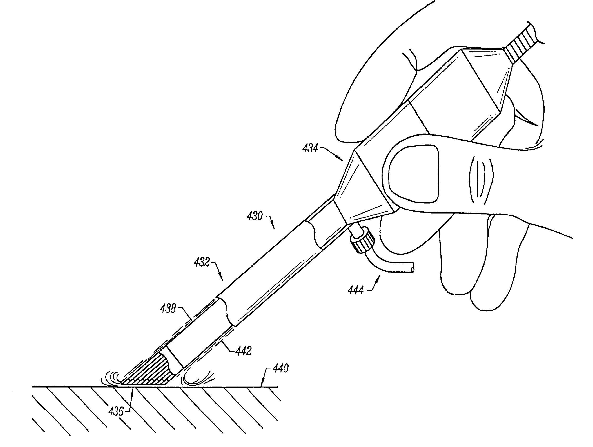 Methods for electrosurgical incisions on external skin surfaces