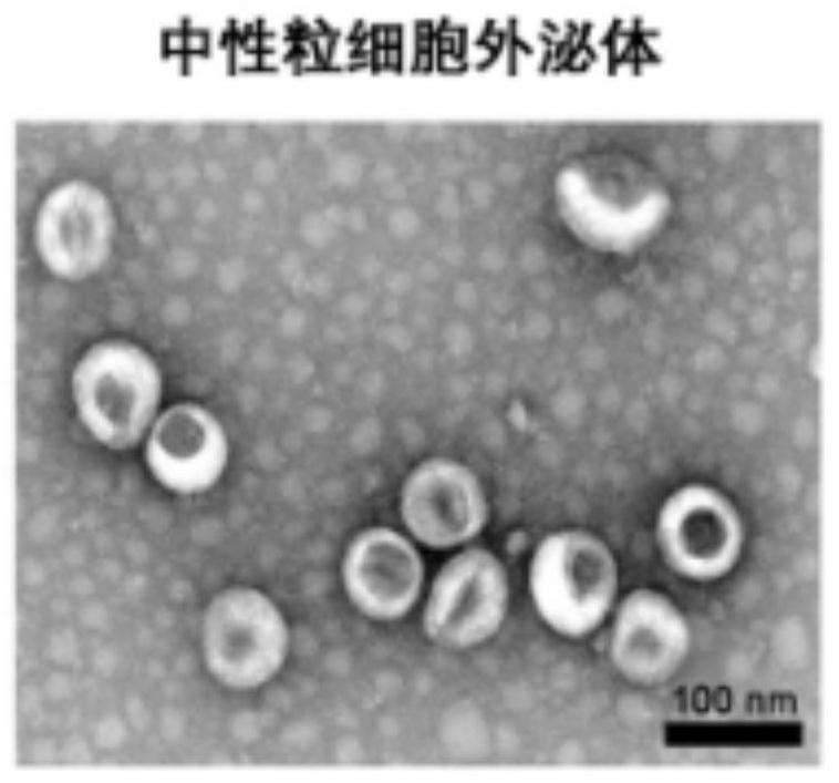 Blood-brain barrier penetrating drug delivery system as well as preparation method and application thereof