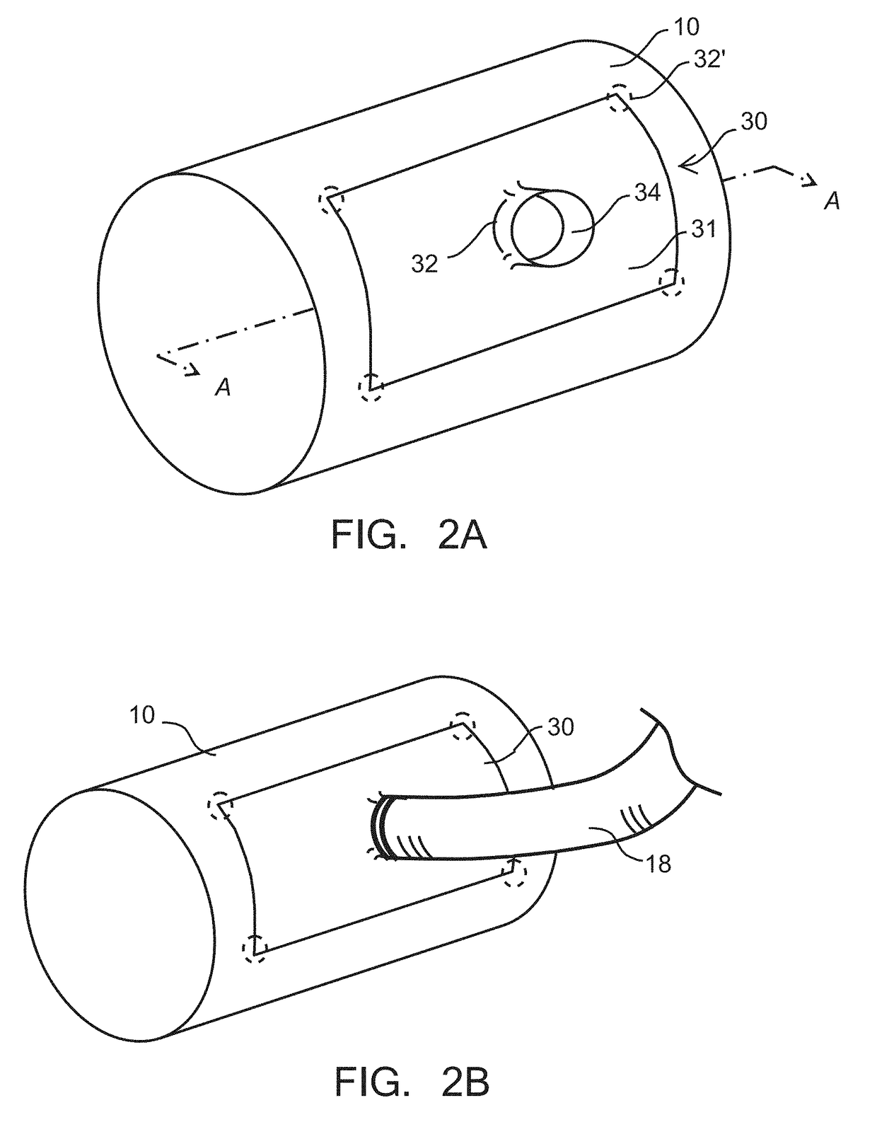 Aortic connectors and methods of use