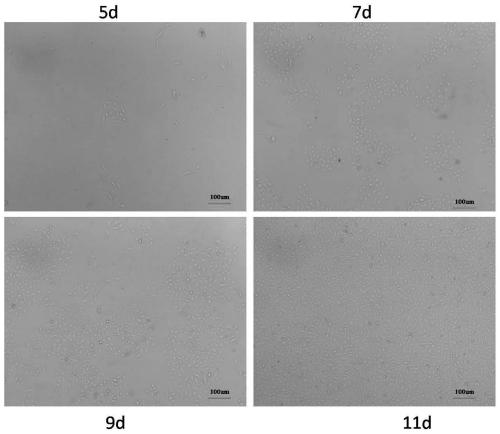 Efficient separation and culture method of fat EPCs (endothelial progenitor cells) without enveloping