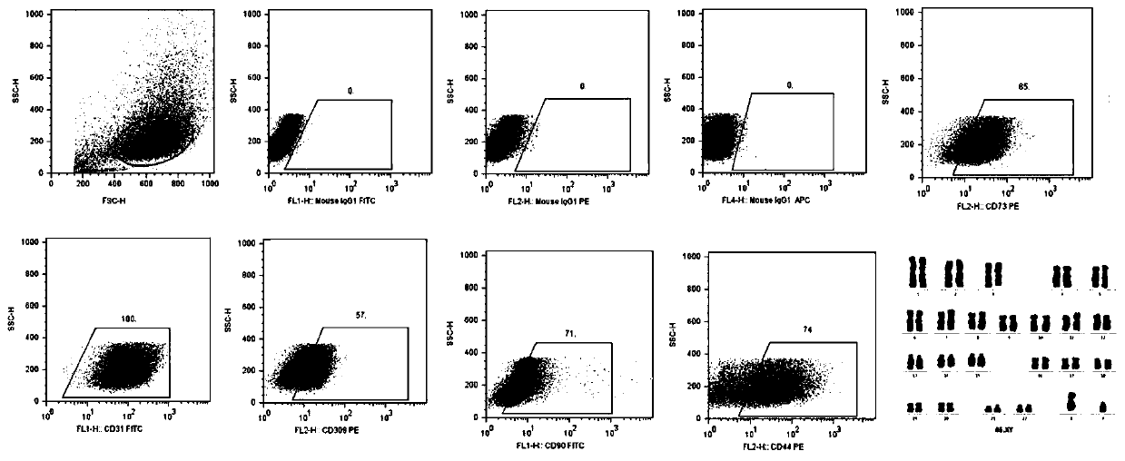 Efficient separation and culture method of fat EPCs (endothelial progenitor cells) without enveloping