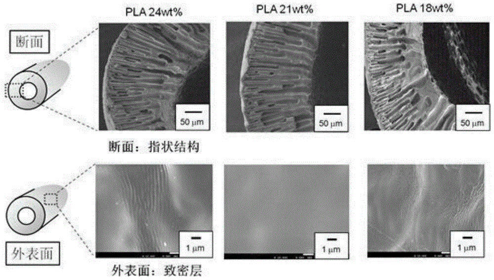 A kind of degradable hollow fiber membrane and preparation method thereof