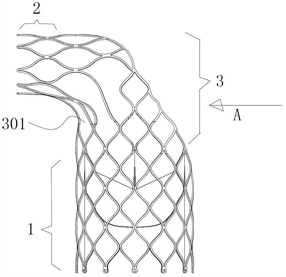 Pulmonary artery valve replacement device and support thereof