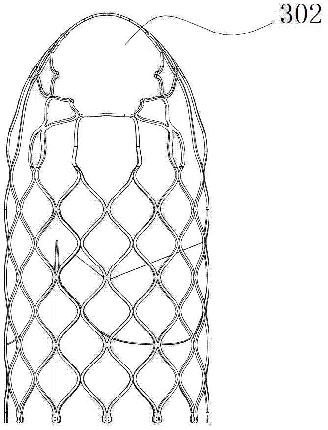 Pulmonary artery valve replacement device and support thereof