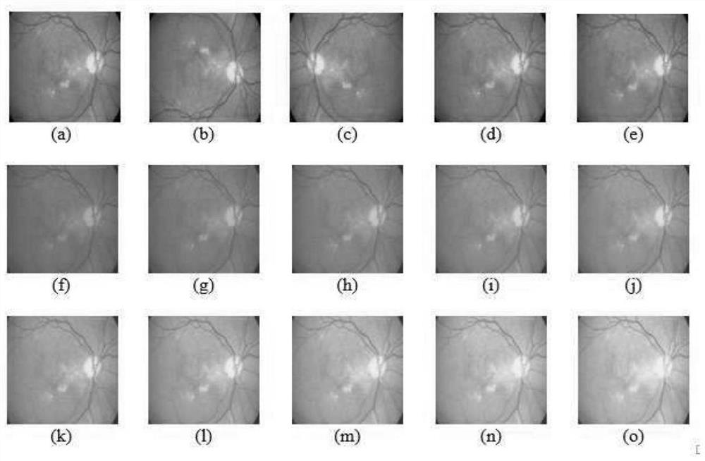 Eye fundus image quality evaluation device and method using transfer learning
