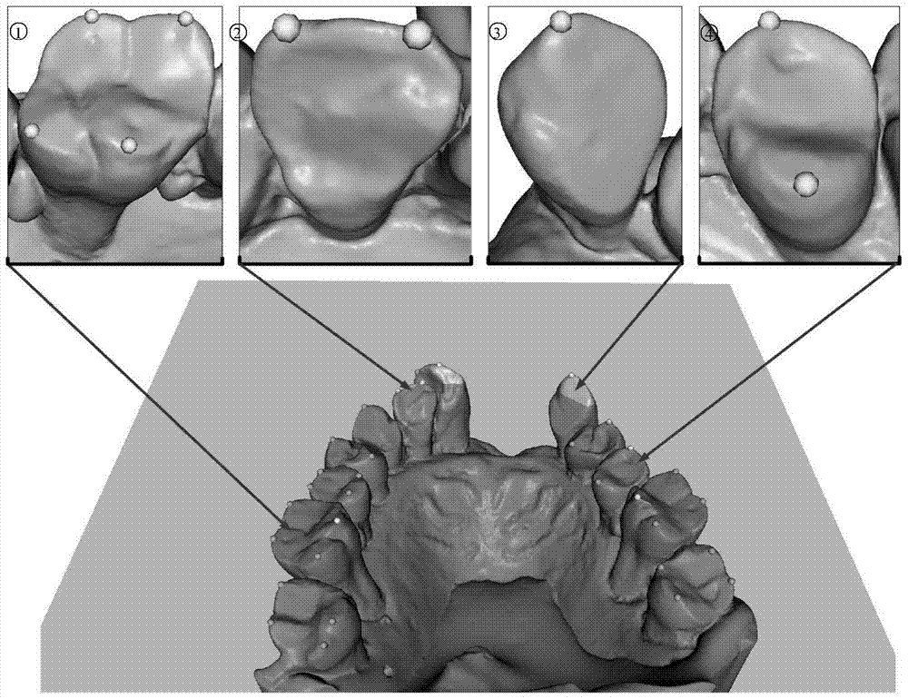 A Method of Automatic Segmentation of All Crowns Based on Harmony Field 3D Model of Dental Jaw