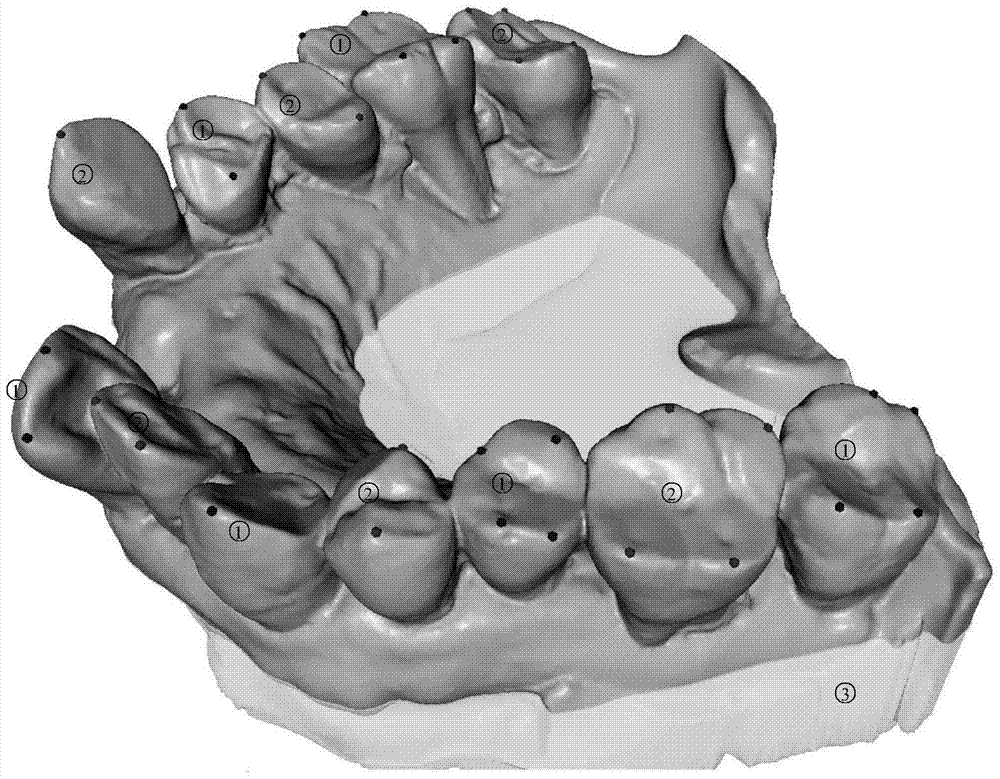 A Method of Automatic Segmentation of All Crowns Based on Harmony Field 3D Model of Dental Jaw