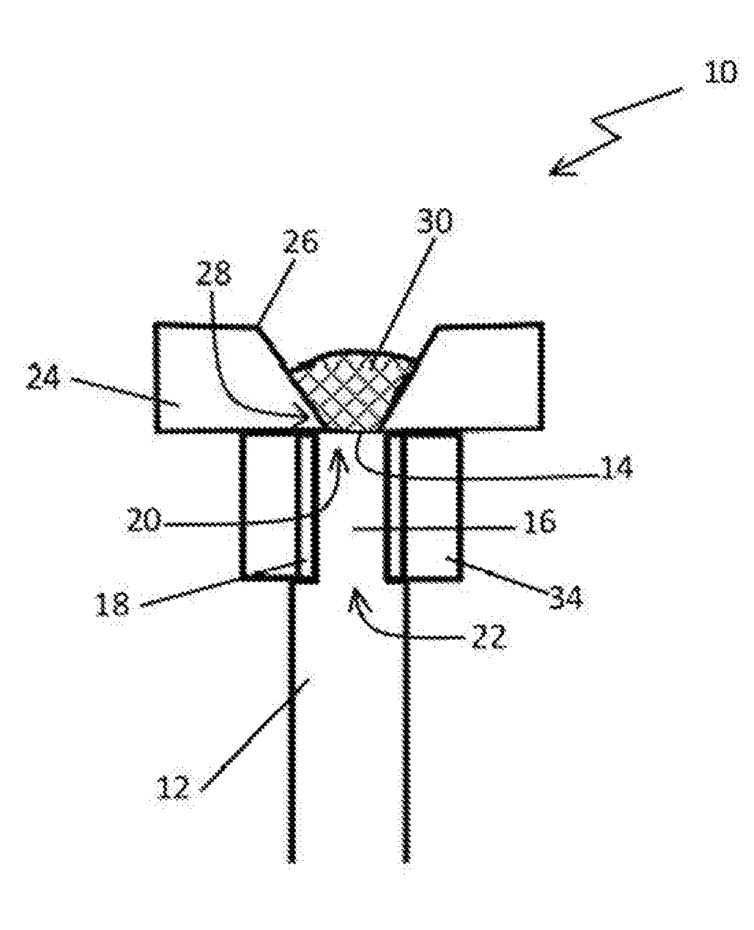 Bioerodible contraceptive implant and methods of use thereof