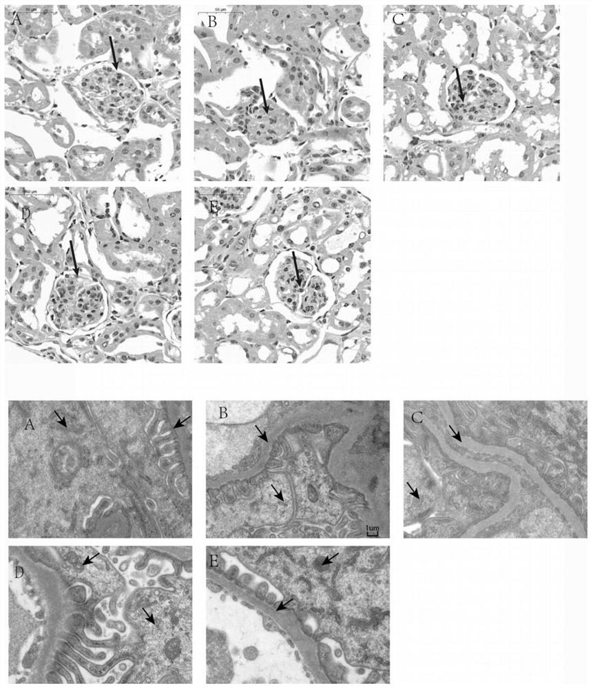 Traditional Chinese medicine monomer isoorientin for treating diabetic nephropathy