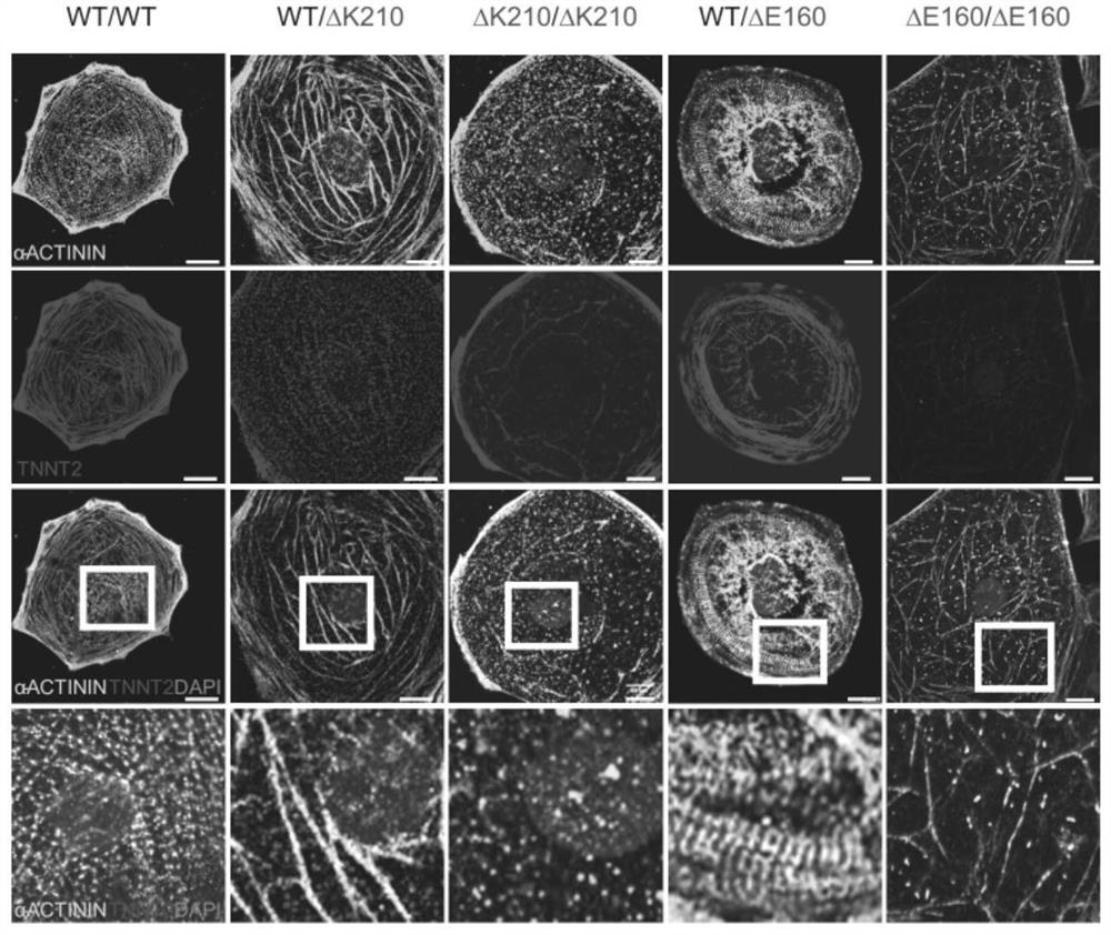 Application of ABRA in preparation of medicine for improving myocardial function of dilated cardiomyopathy