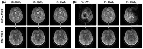 3D gradient spin echo imaging method and device for oscillation gradient preparation