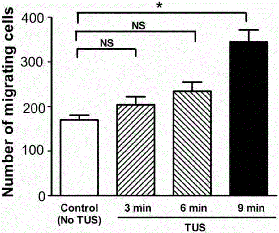 Regulation and control device for eNOS (Endothelial nitric oxide synthase) expression and activation and treatment device for peripheral arterial diseases