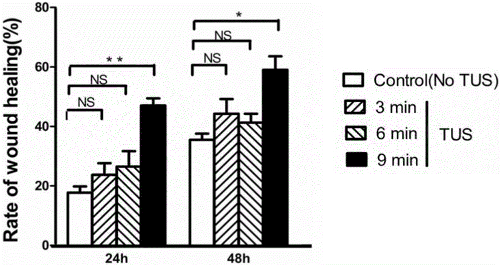 Regulation and control device for eNOS (Endothelial nitric oxide synthase) expression and activation and treatment device for peripheral arterial diseases