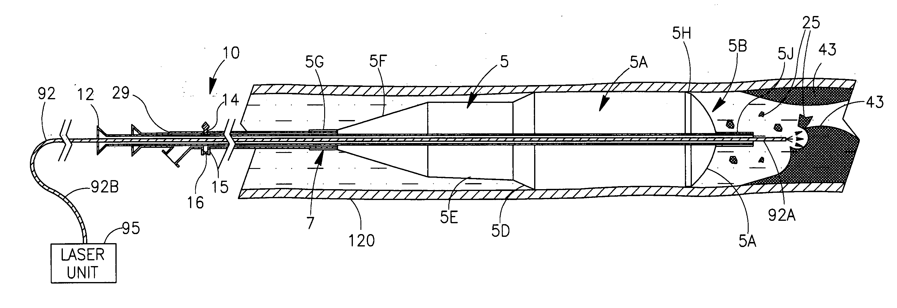 Balloon catheter system and methods of use thereof