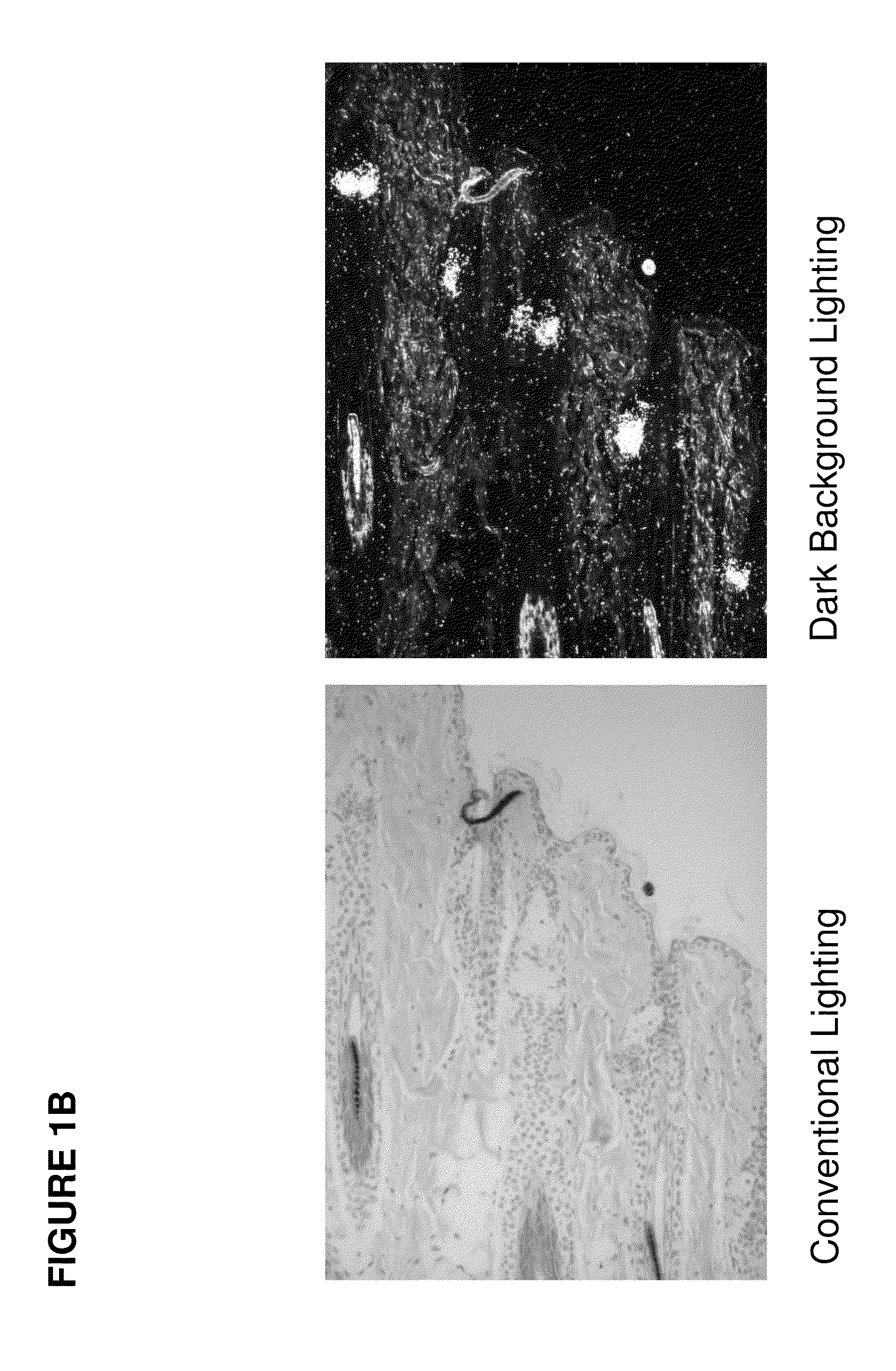 Modulators of ELOVL5 for treating acne or hyperseborrhea