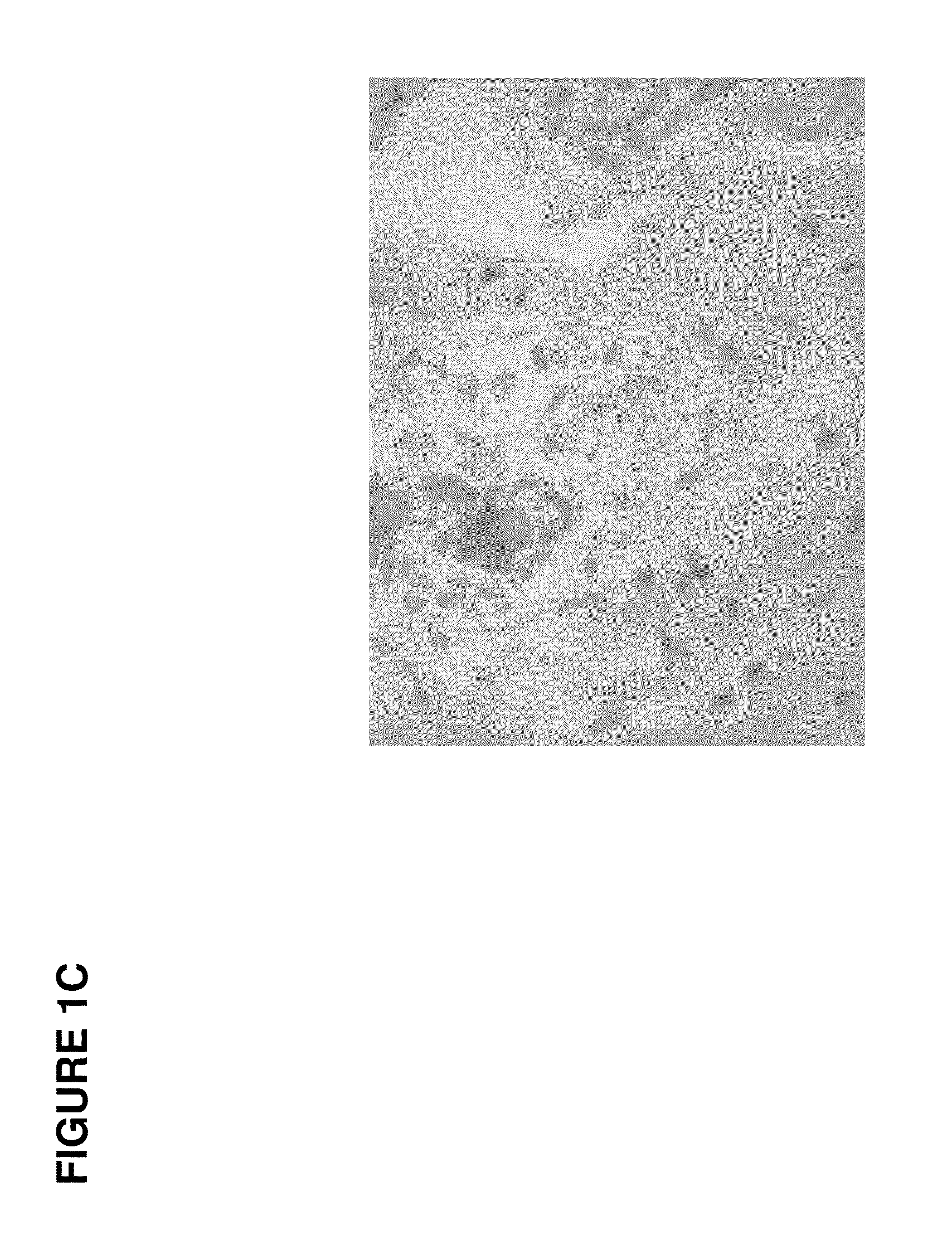 Modulators of ELOVL5 for treating acne or hyperseborrhea