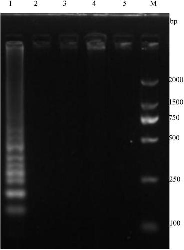 LAMP detection kit and detection primers for pathogenic bacteria of bacterial mumps of pelodiscus sinensis