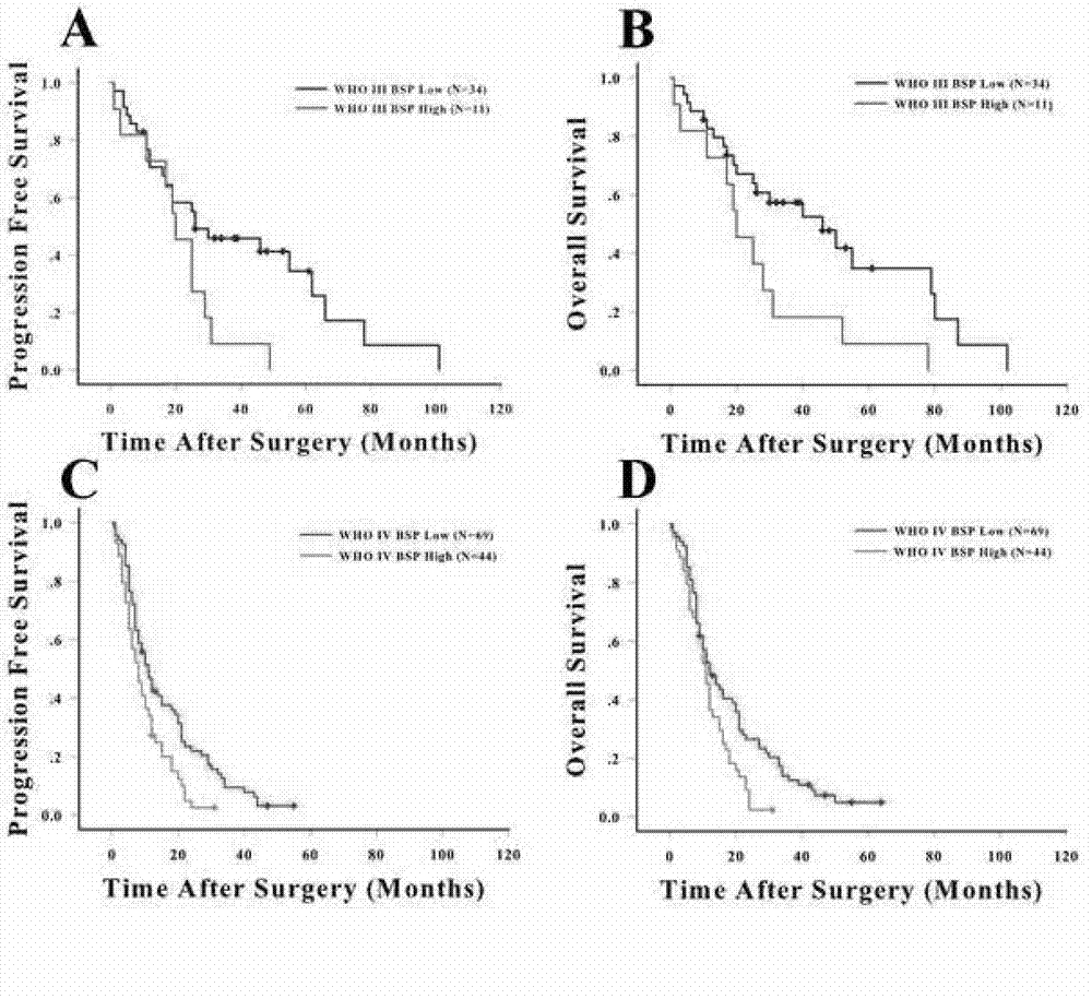 Method for detecting expression of bone sialoprotein (BSP) in brain glioma by utilizing high-throughput tissue chip