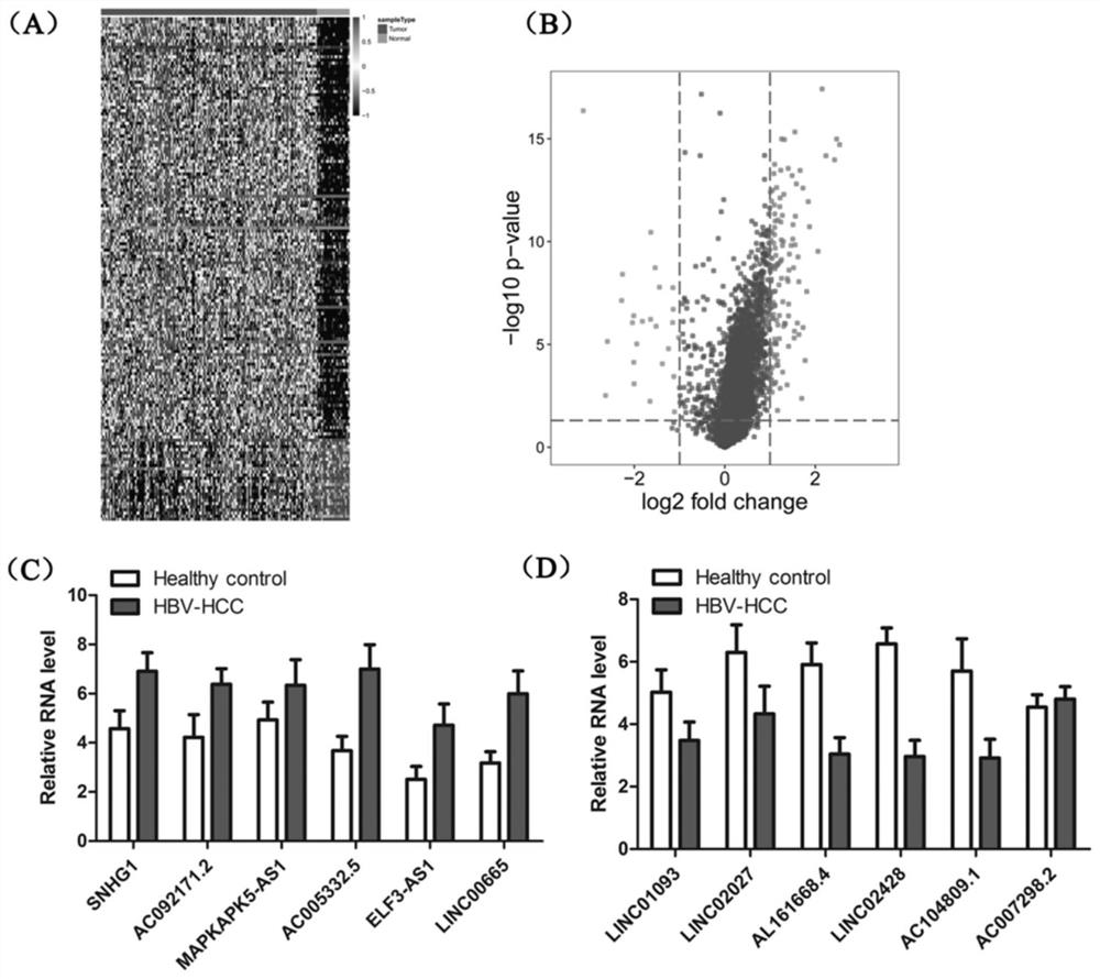 Application of biomarker in diagnosis and prognosis of HBV (Hepatitis B Virus) related liver cancer