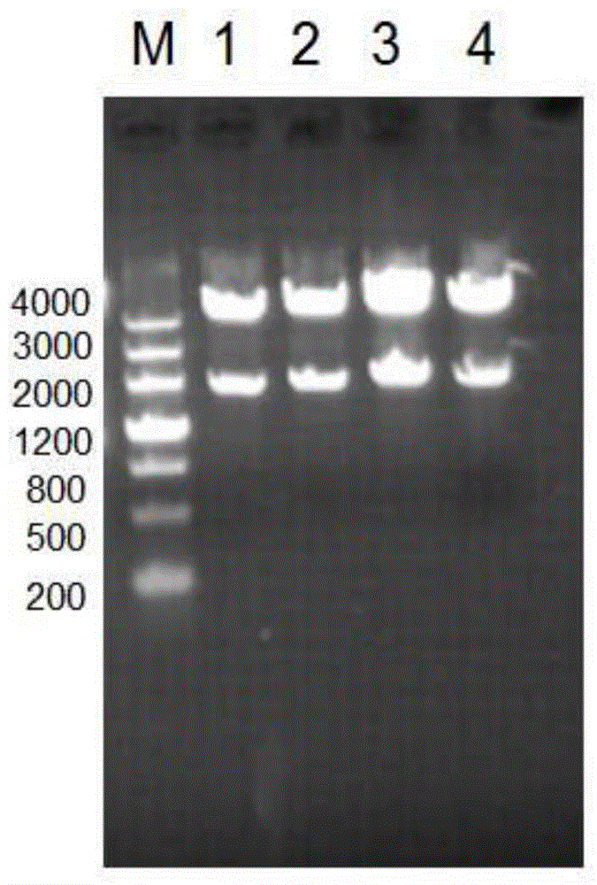 Acinetobacter baumannii zinc dependent oligopeptide A1S-1610 recombinant protein and preparation method and application thereof