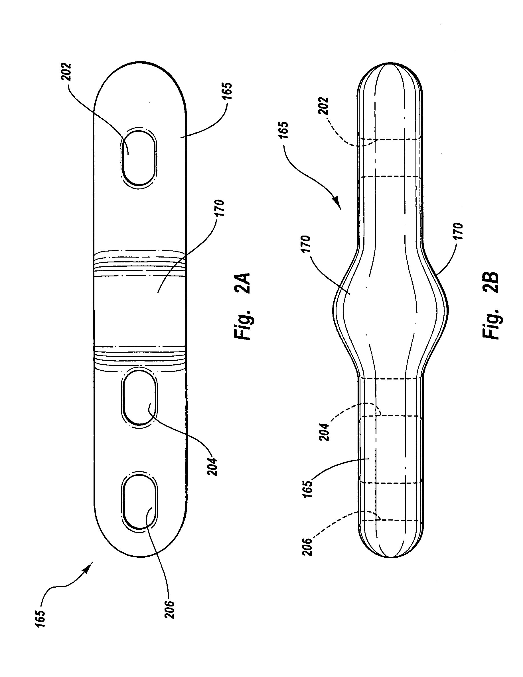 Method and apparatus for sealing an internal tissue puncture incorporating a block and tackle