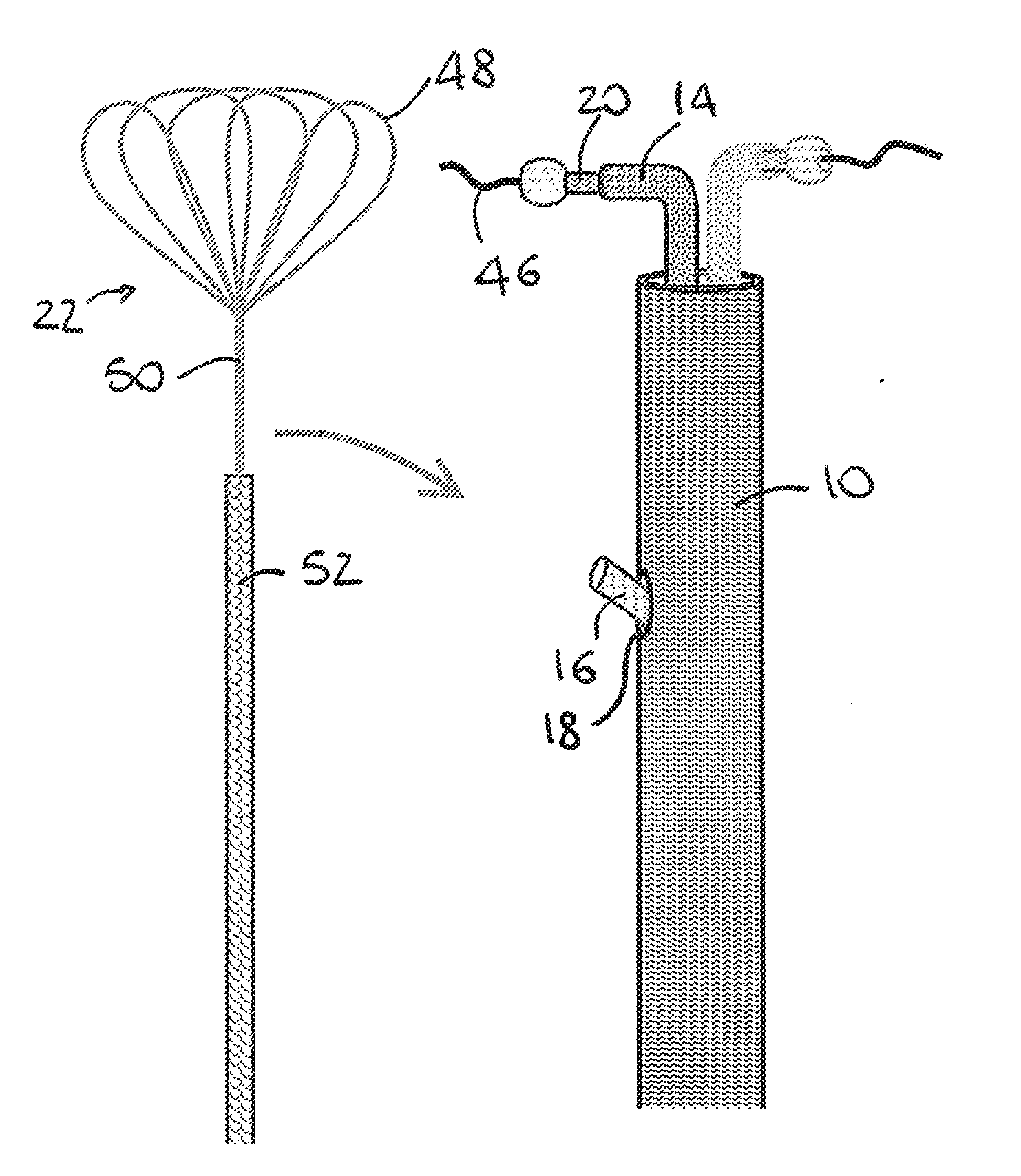 Device for the Deployment of a System of Guide Wires Within a Cardiac Chamber for Implanting a Prosthetic Heart Valve