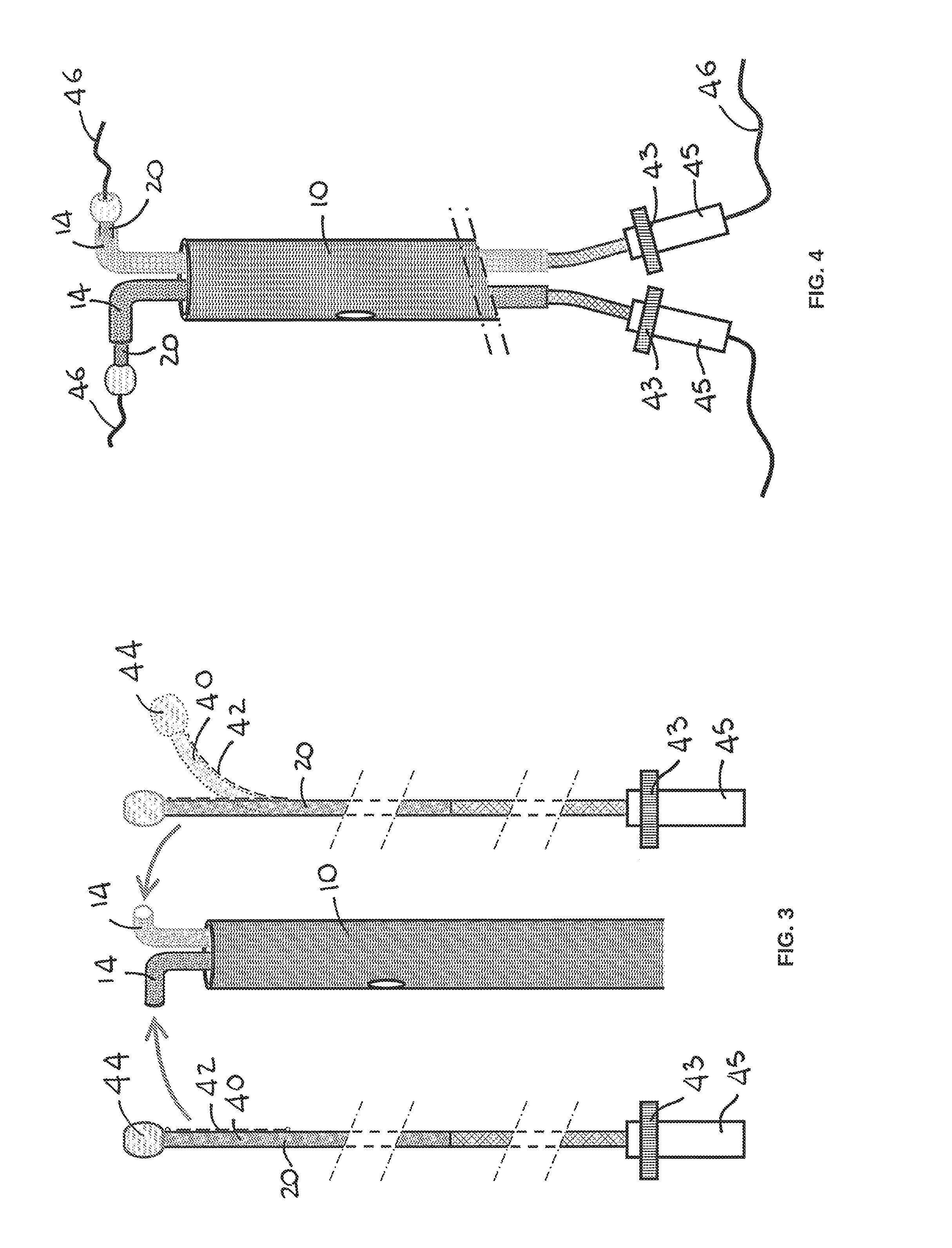 Device for the Deployment of a System of Guide Wires Within a Cardiac Chamber for Implanting a Prosthetic Heart Valve
