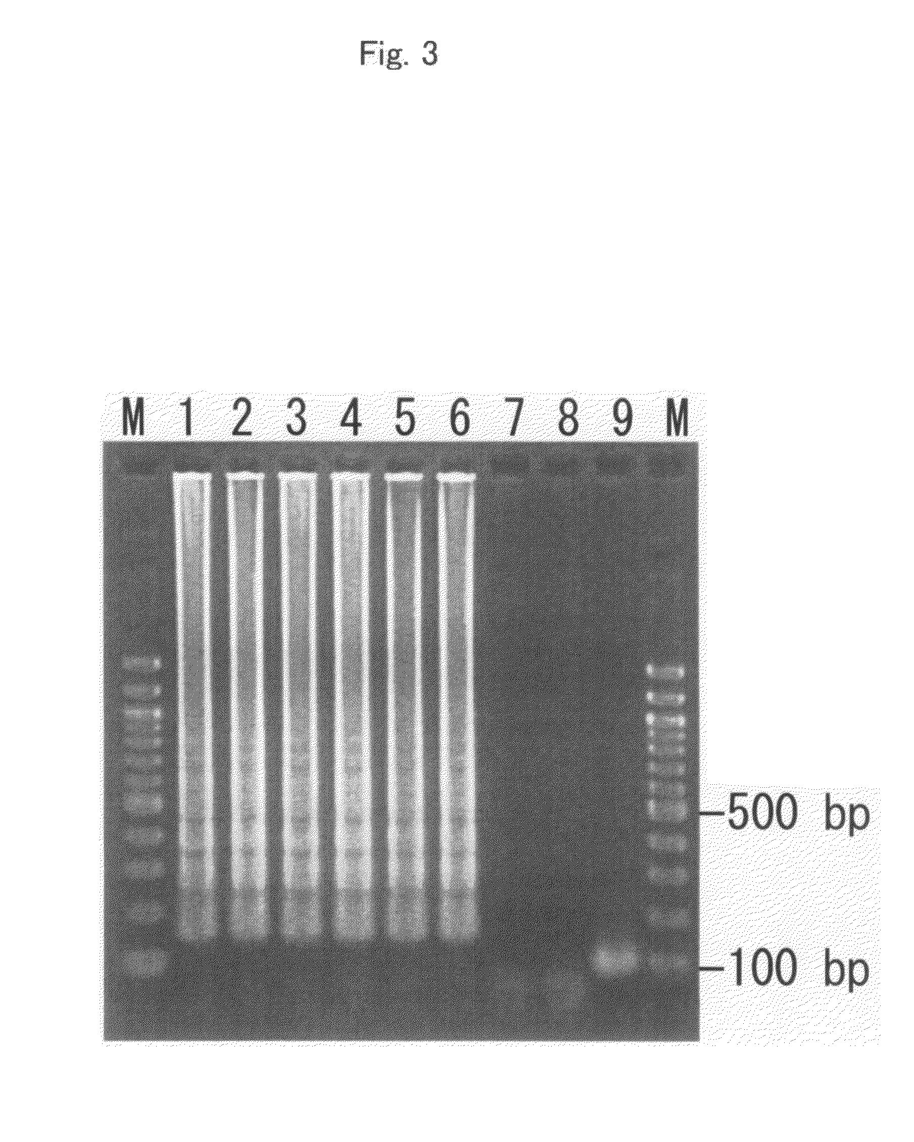 Method of detecting Streptococcus pneumoniae, primer set for the detection and kit for the detection