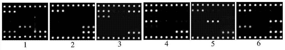 Gene chip, kit and method for detecting three viruses for immunosuppression disease of chickens