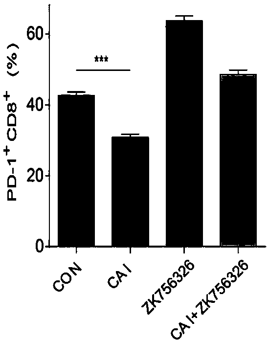 Application of CAI (Carboxyamidotriazole) and IDO1 (Indoleamine 2,3-Dioxygenase) inhibitor combination in resisting tumor