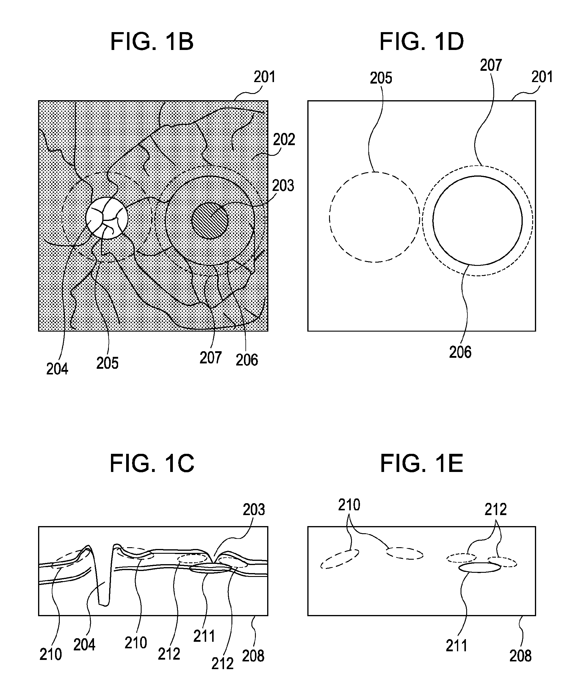 Image acquisition apparatus and image acquisition method using optical coherence tomography