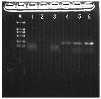 Cloning method of perinereis aibuhitensis metal binding protein gene