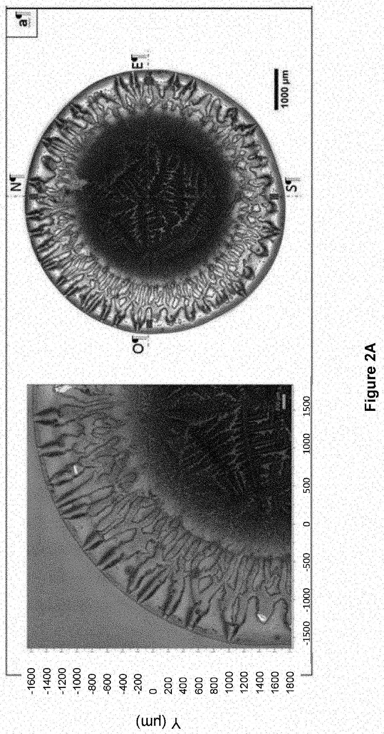 Method for detecting joint diseases